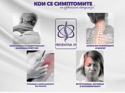 Кои се симптомите на цервикална спондилоза
